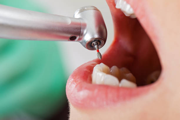 Best Emergency Treatment for Toothache in Liberty Lake, WA